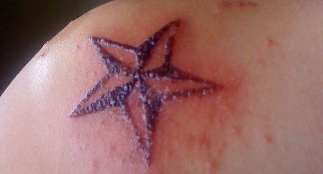 tattoo-rash-2_1.jpg