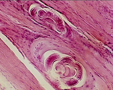 A trichinózissal fertőzött húst semlegesítik az emberi testben élő paraziták gyógyszerei