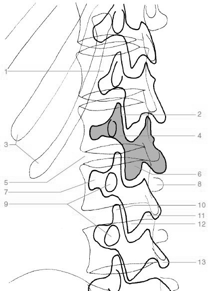 arcus vertebrae