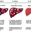 Májbetegségek