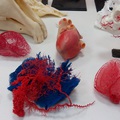 3D nyomtatás az orvoslásban és az oktatásban