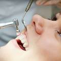 A fogágybetegség kezelése