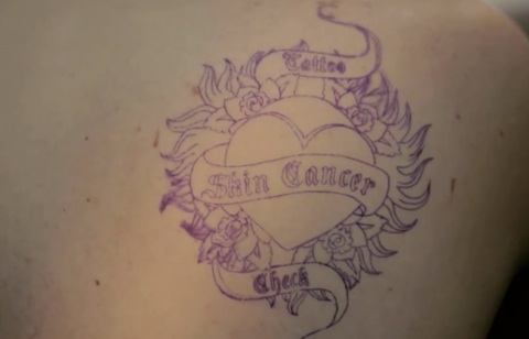 skin-cancer-check_tattoo.jpg