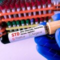 "Az STD Szűrés: Az Egészségmegőrzés Kiemelkedő Fontossága"