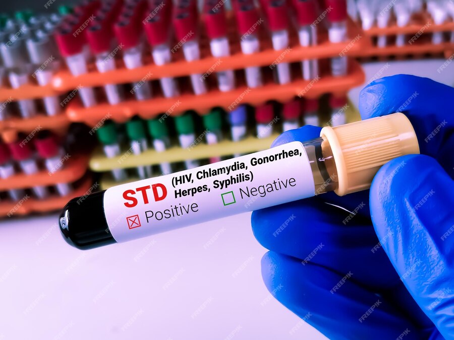 blood-sample-std-sexually-transmitted-disease-test-with-laboratory-background_595440-3269.jpg