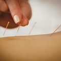 Példátlan előrelépések az akupunktúra alkalmazásában