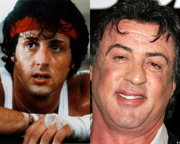 menkedd-sly-sylvester-stallone-plasztika-high-care.jpg