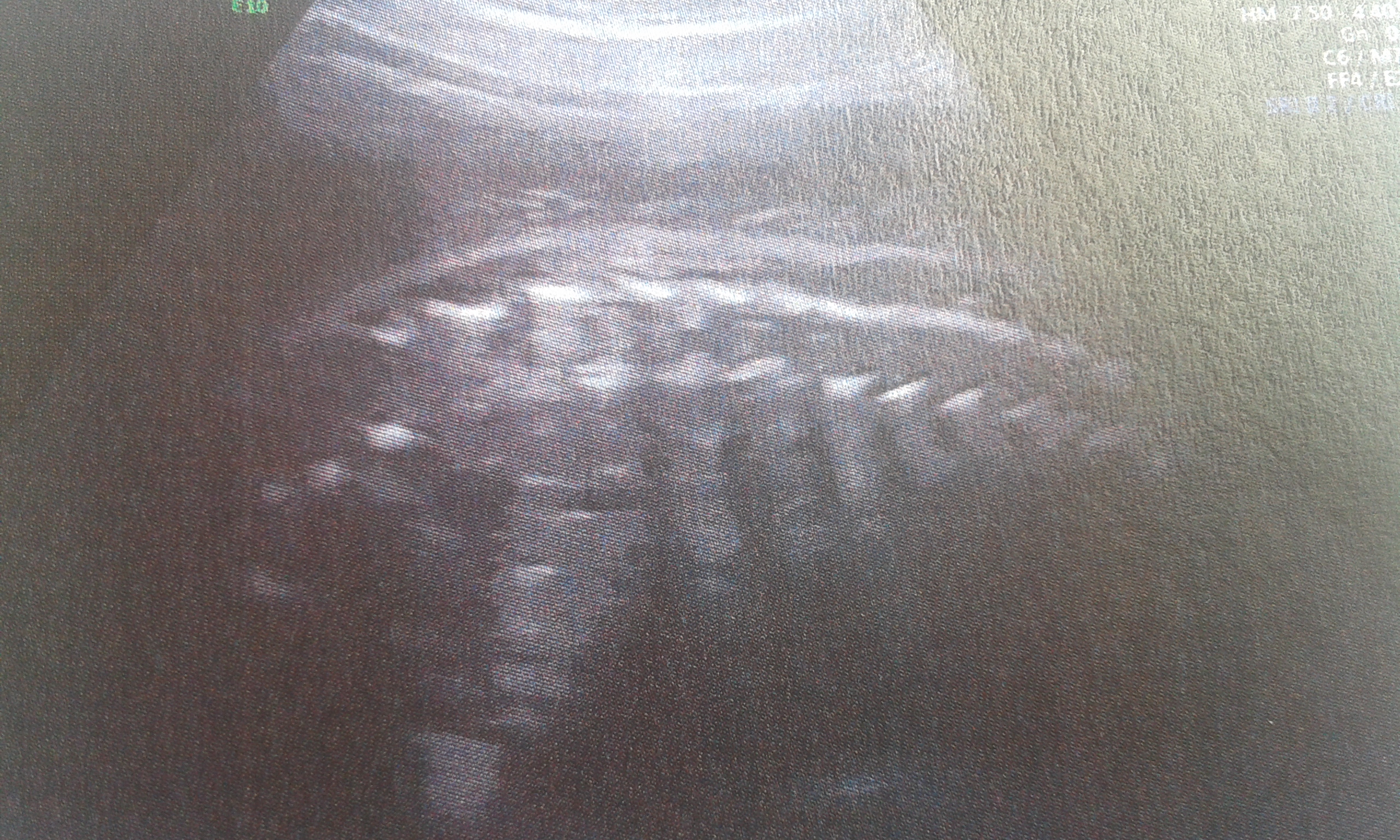 20160920_122751.jpg