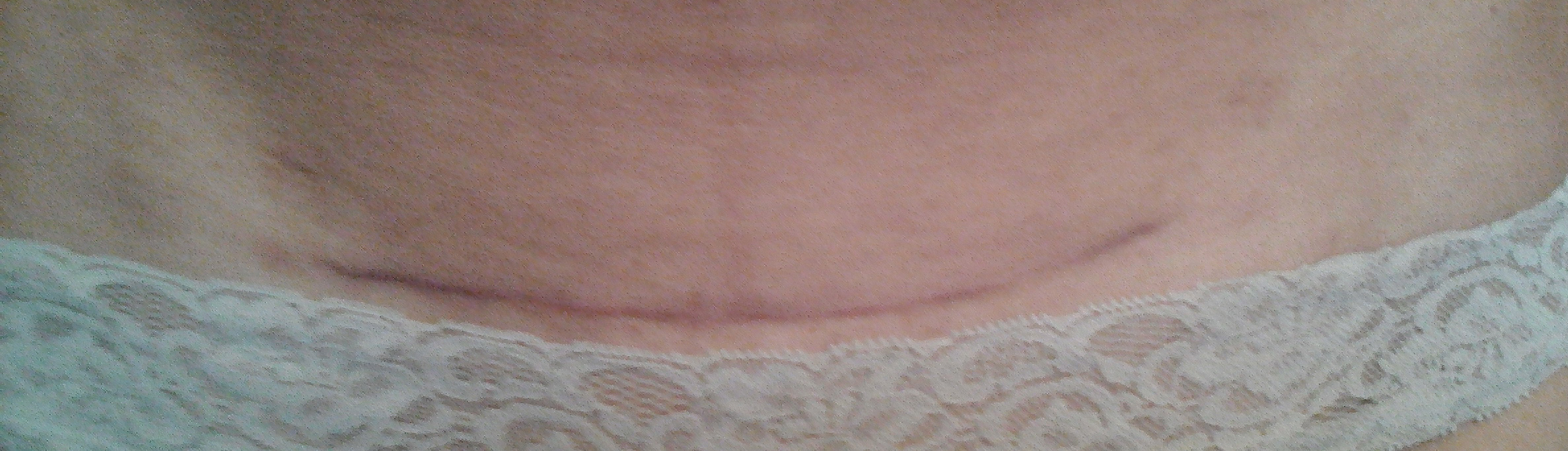 lenovo_a1000_img_20170103_154229_1.jpg