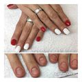 #beforeafter #nailart #nailinstagram #nails #nail #nailstagram #nailcorection #rednails #whitenails