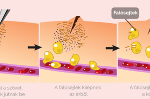 06. Immunrendszer Érettségi