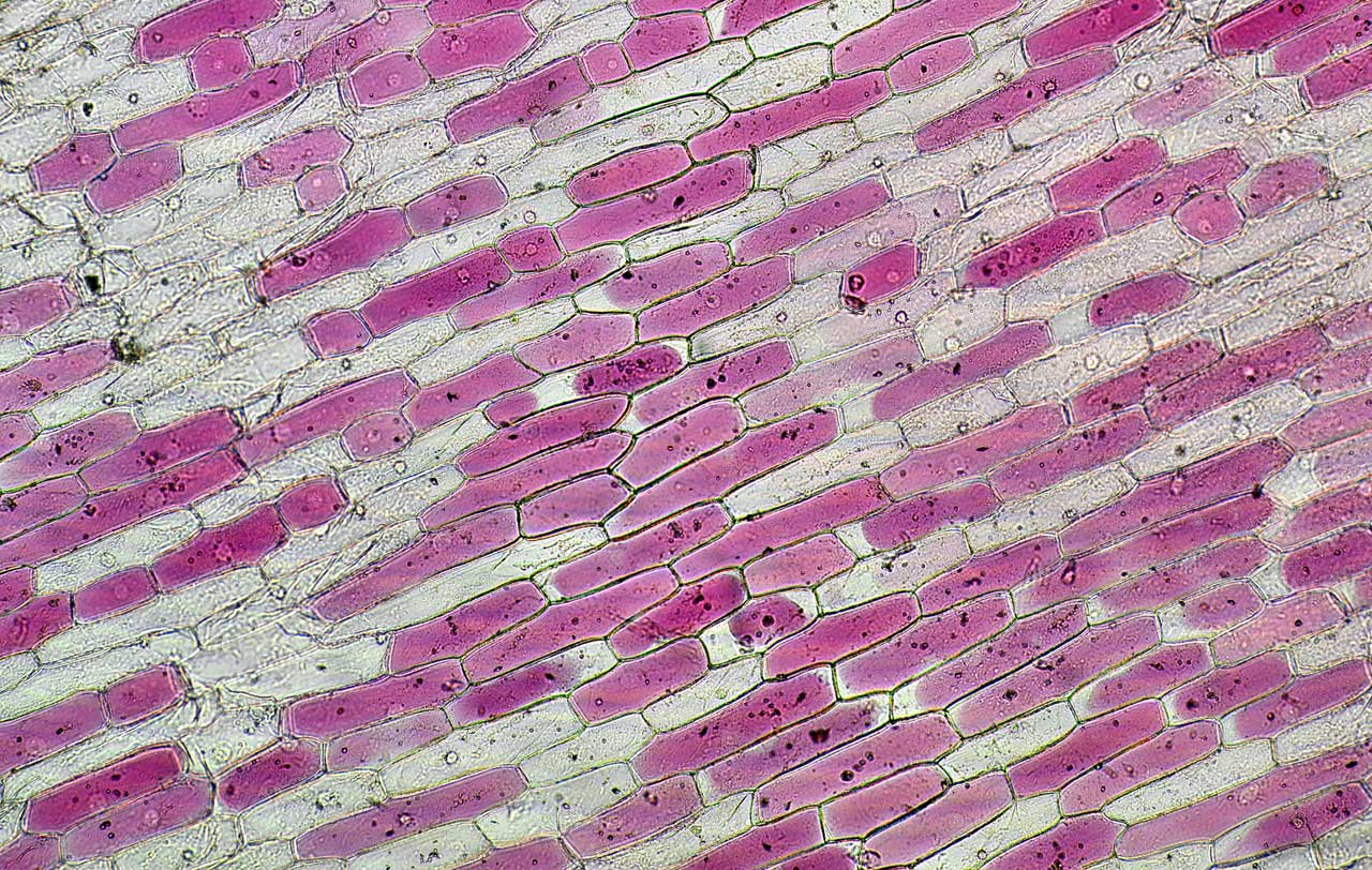 Növényi bőrszöveti sejt konvex és konkáv plazmolízise, deplazmolízis