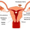 Mindent a menstruációról biologikusan - görcsök, erős vérzés, vérzés kimaradás, első menstruáció pubertás korban