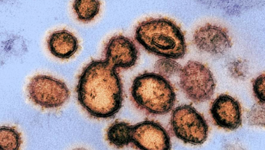 A koronavírus megmarad a helyiségekben és a WC-kben, de a fertőtlenítőszerek megölik: Szingapúr-tanulmány