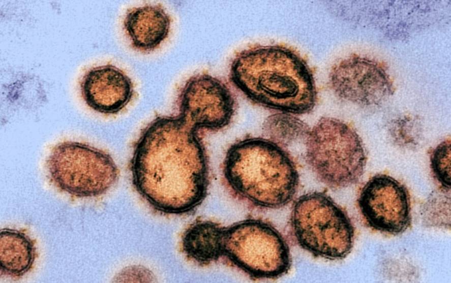 koronavirus-bactakleen-mezoturon.jpg
