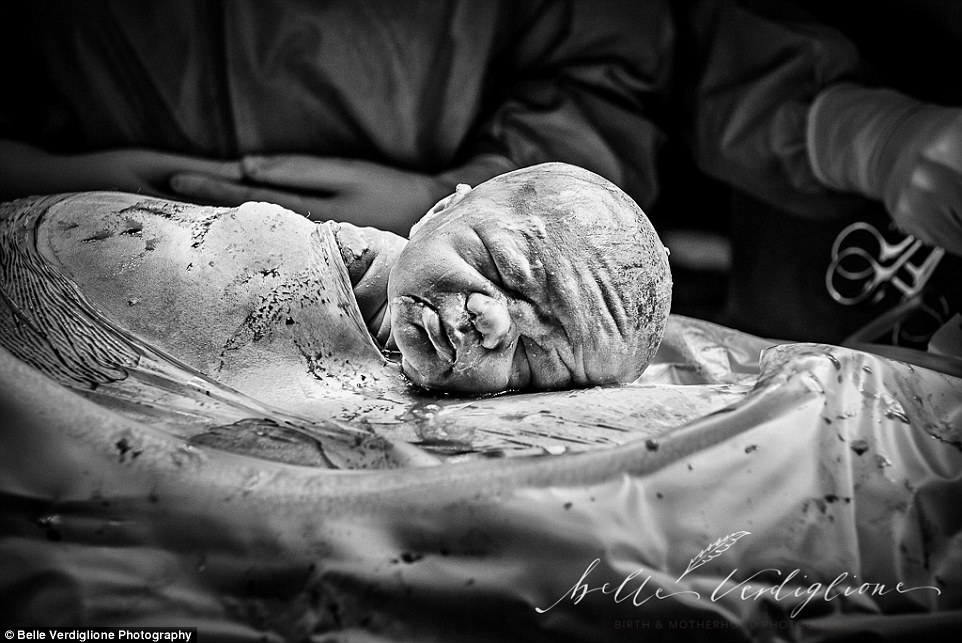 this_gentle_but_intricately_detailed_image_shows_the_aftermath_of_a_quiet_cesarean_birth_by_belle_verdiglione.jpg