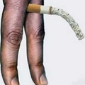 A dohány-diszkrimináció