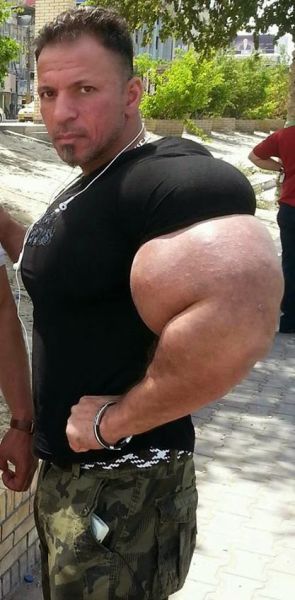 synthol_18.jpg