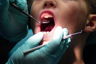 Új fogorvosi körzetek jönnek létre Érden november 1-től, túl sok a beteg