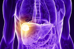 ELŐRELÉPÉS MÁJRÁK-ÜGYBEN: bélbaktériumok is befolyásolhatják a daganat növekedését