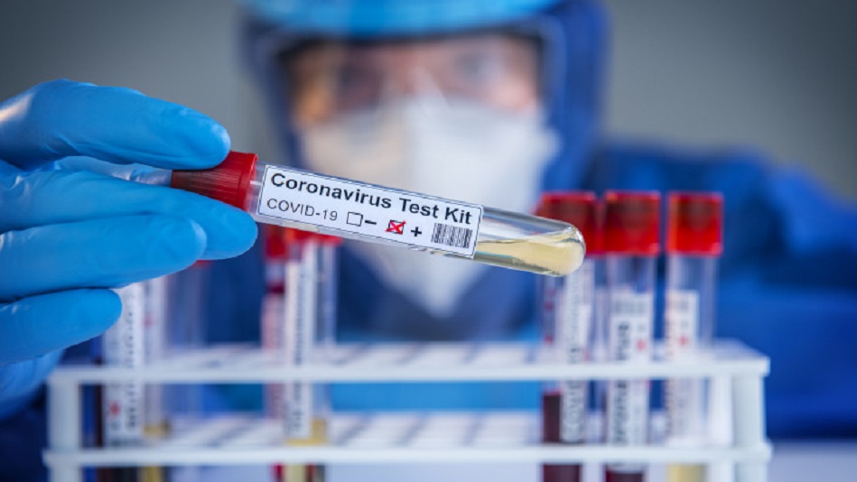 koronavirus-teszt-covid-jarvany-362216.jpg