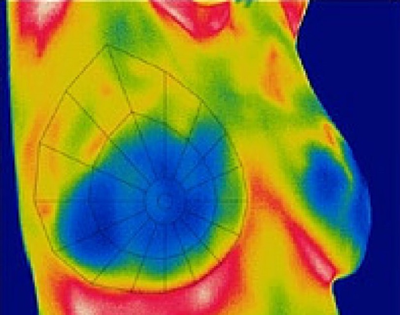 A JÖVŐ ÚTJA! Ön is  otthonában diagnosztizálhatja az esetleges daganatot Tatabányán