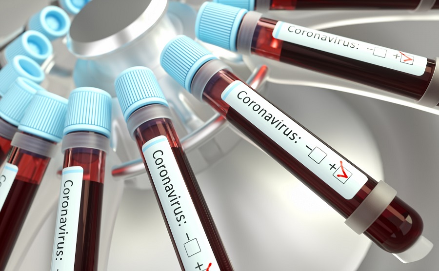 A KORMÁNY SZAKÉRTŐI BEVALLOTTÁK: jönnek a koronavírus súlyos esetei, nincs több teszt!