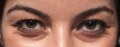 eye-wrinkles-smiling-female-eyes-radiating-concentric-furrows-32800017.jpg
