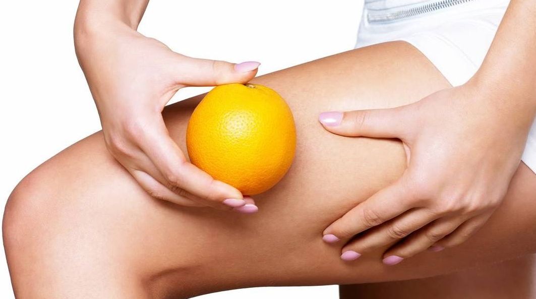 the-invention-of-cellulite-body-image-1460046250_1.jpg