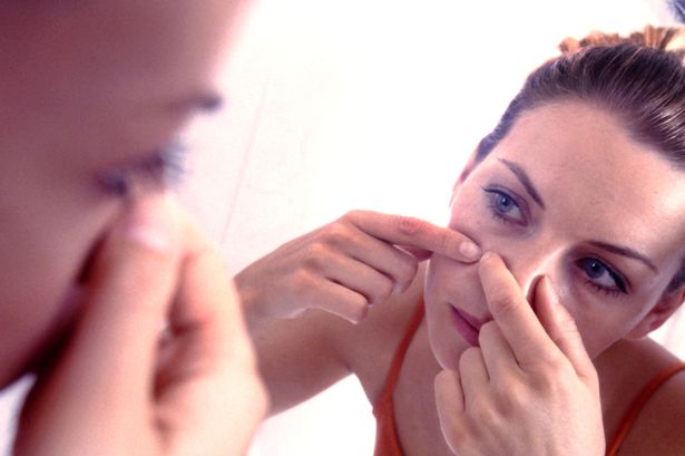 woman-squeezing-pimple-on-her-cheek.jpg