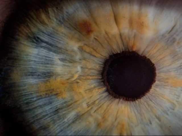 Edényben nőtt retinák kukucskáltak a kutatókra