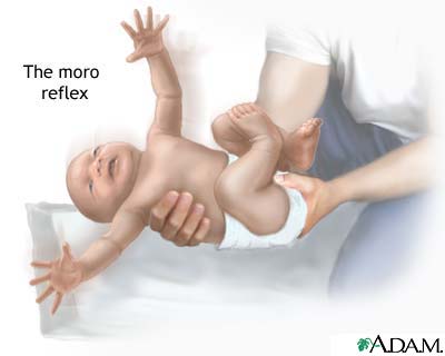 moro reflex.jpg