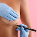 Tudtad? Mellplasztika után így viselkedik a hormonok hada