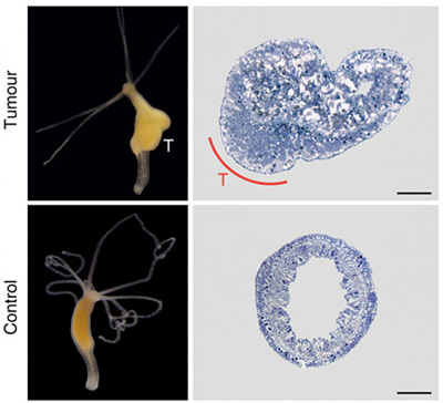 hydra_tumour_1.jpg