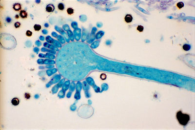 aspergillus.jpg