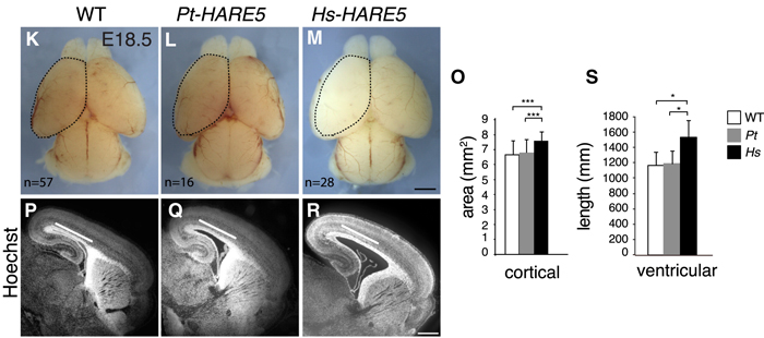 hare5-fzd8-brainsize.jpg