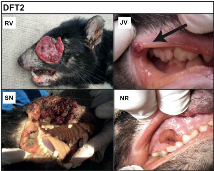 dft2-tumour.jpg