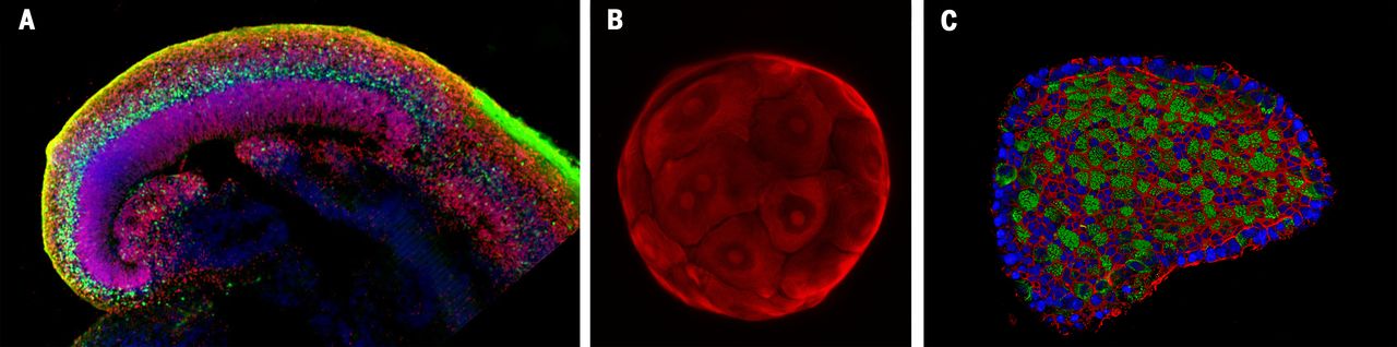 organoid_examples.jpg