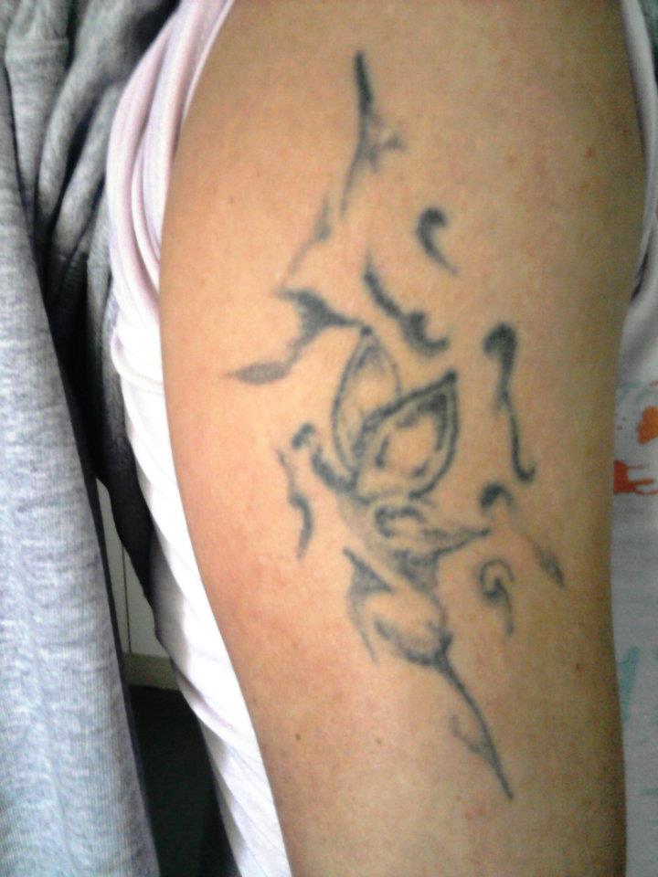 Tetoválás eltüntetése csillámporral.jpg