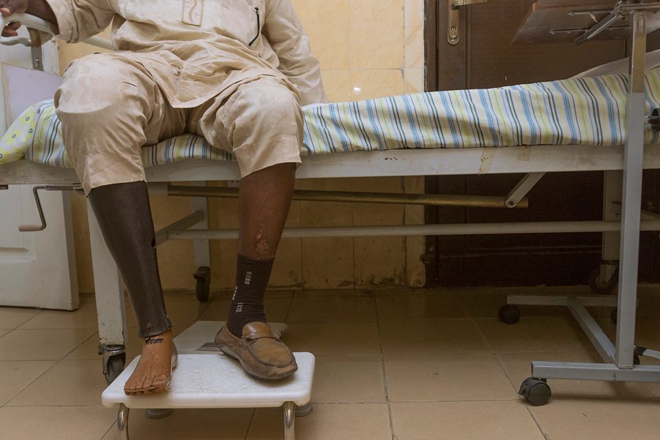 Adeniran, Nigéria: 54 éves, rendszeres kontrollra Lekkibe jár, Lagosba. A helyi cukorbeteg szervezet vezetője. 2-es típusú cukorbeteg. A jobb lábát amputálni kellett, ezért protézist használ. Nagyon odafigyel a vércukraira és maximálisan együttműködik orvosaival.
