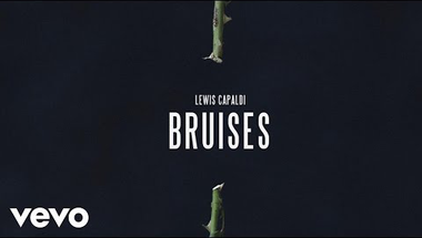 Lewis Capaldi: Bruises magyarul