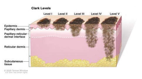 484px-clark_levels.jpg