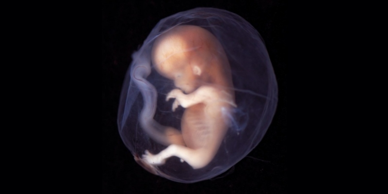 abortusz1.jpg