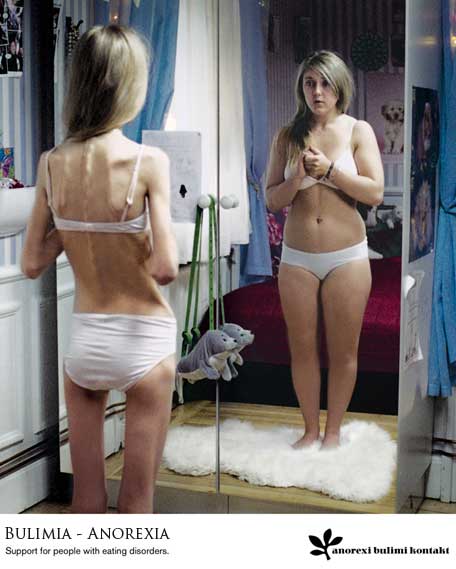 anorexia.jpg