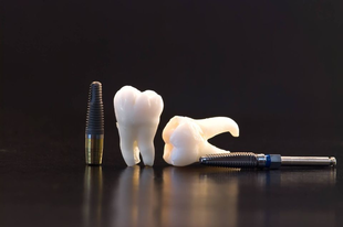 Implantáció csonthiányos és rizikós esetekben