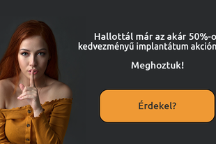 50%-os implantátum akció egyes implantátumokra