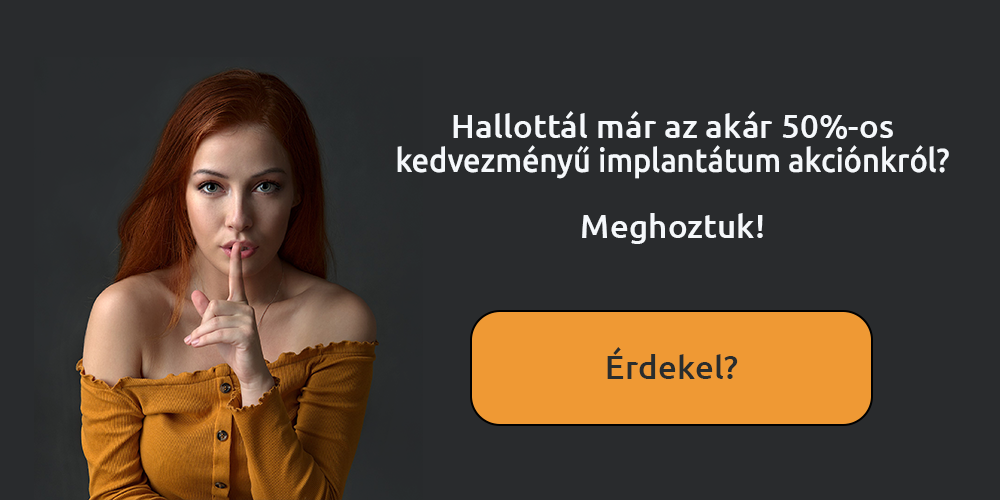 akciop_popup2_fbra.png
