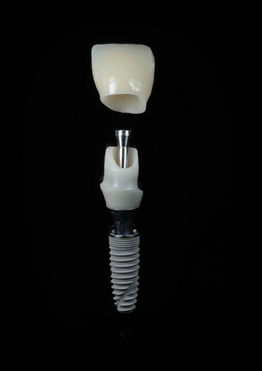 implantatum_drtothgasparmate_gasparmedicalcenter2_kicsi.jpg