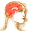 Az agyvérzés: a stroke