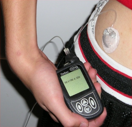 Insulin_pump_with_infusion_set.jpg